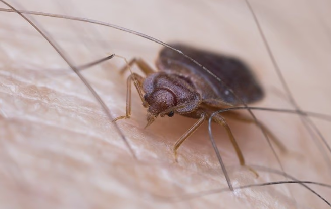 bed bug up close on hairy skin